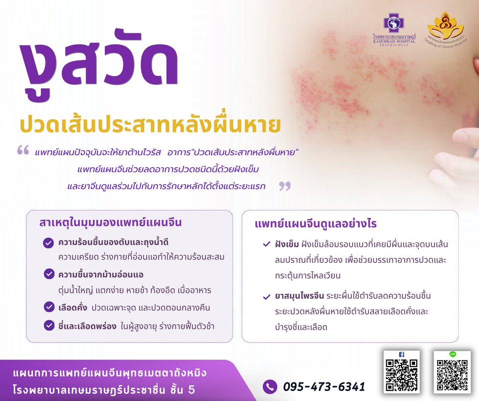 งูสวัด ปวดเส้นประสาทหลังผื่นหาย รักษาอย่างไร โรงพยาบาลเกษมราษฎร์ ประชาชื่น